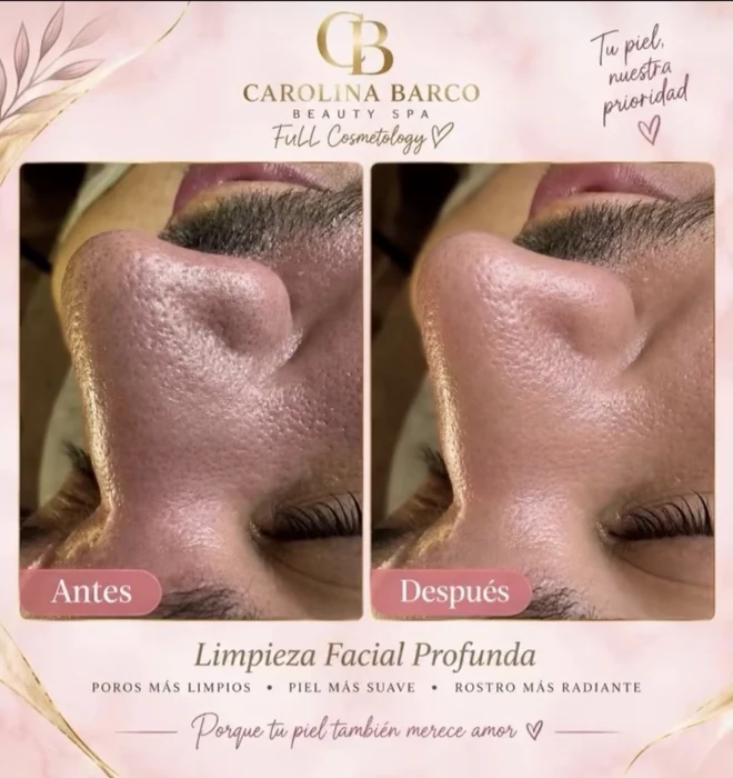 Limpieza facial profunda: publicación de antes y después